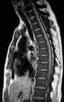 4.fluorosis.jpg