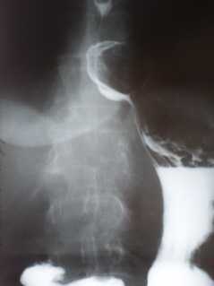 Изображение - Дисплазия т б суставов рентген снимки 1-1_2
