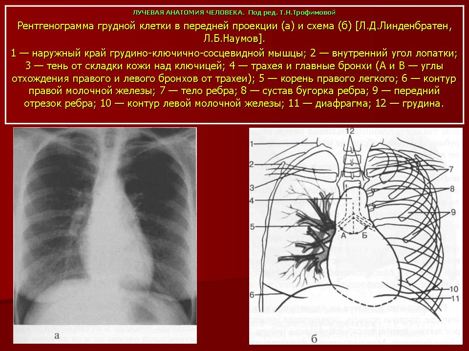 Легочный рисунок рентген