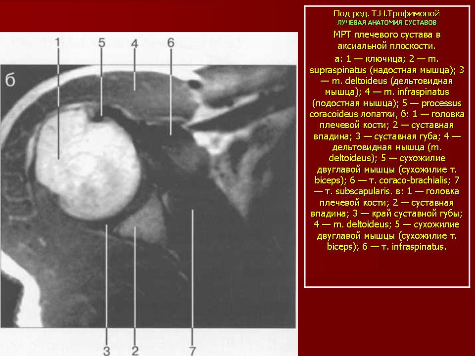 Мрт мышц плечевого сустава