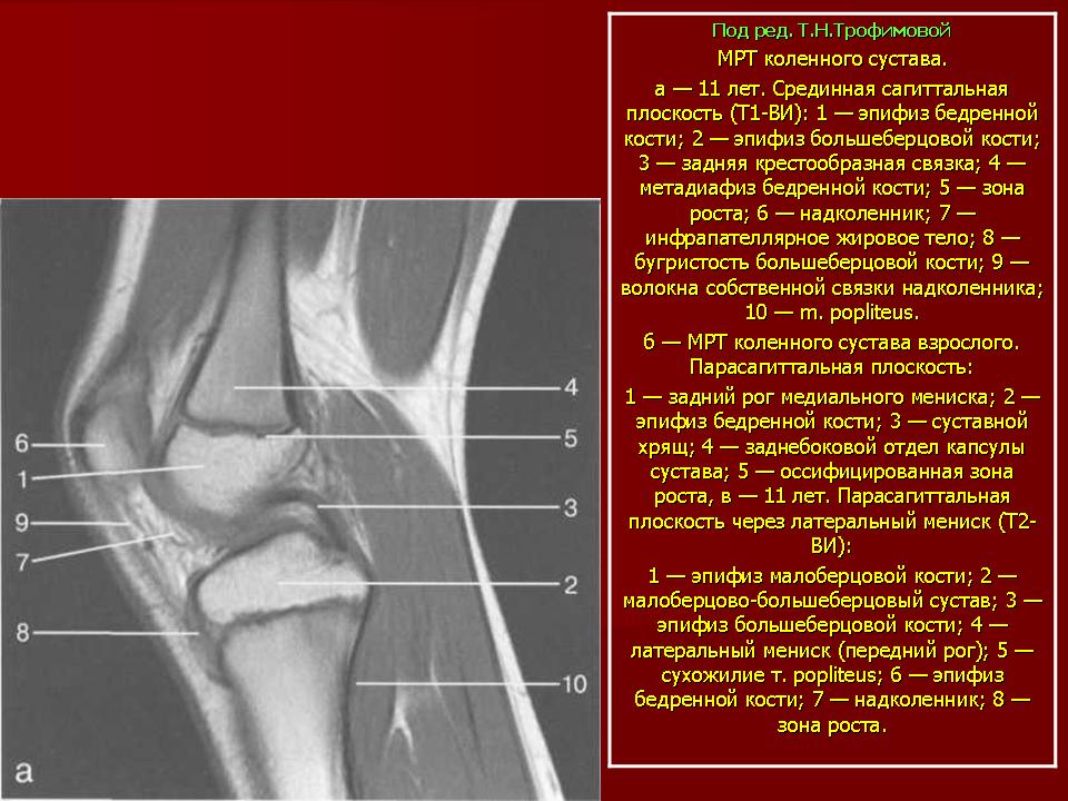 Наружный мыщелок большеберцовой. Связки коленного сустава анатомия кт. Рентген коленного сустава зона роста. Реконверсия костного мозга коленного сустава. Передний мыщелок большеберцовой кости.