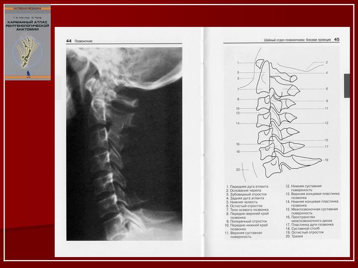 Анатомия рентген. Карманный атлас рентгенологической анатомии т.б мёллер. Меллер, Райф: карманный атлас рентгенологической анатомии. Карманный атлас рентгенолога. Атлас рентгенологической анатомии Меллера.
