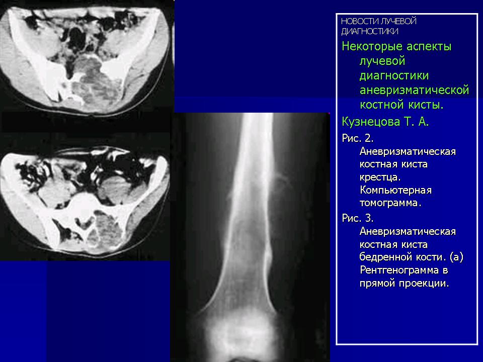 Лечение миофасциальной боли клиническое руководство pdf