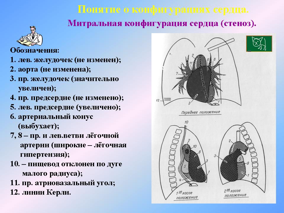 Нормальная конфигурация сердца рисунок