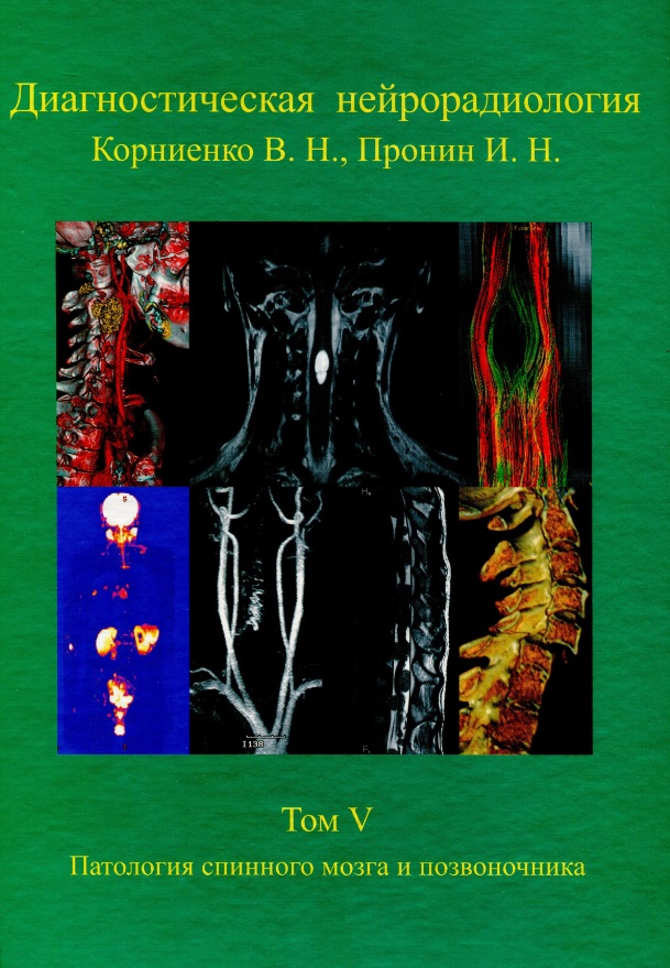 5 патологий. Диагностическая нейрорадиология Корниенко. Корниенко Пронин диагностическая нейрорадиология. Диагностическая нейрорадиология том 6. Диагностическая нейрорадиология Пронин книга.