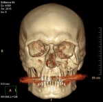 rentgenolog-2011 аватар