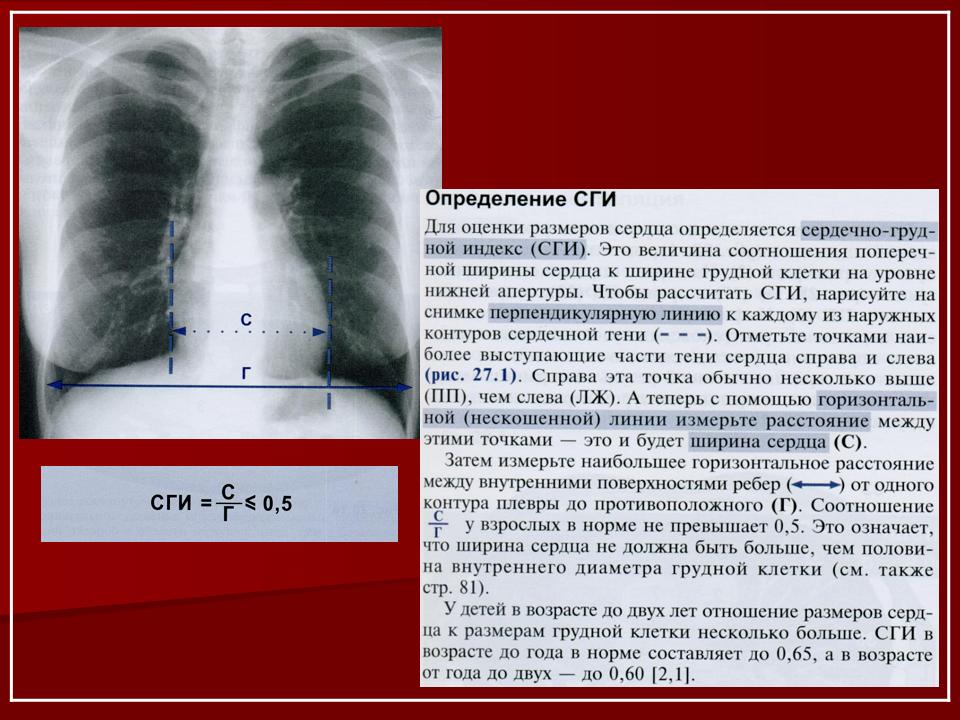 Какие легкие в норме