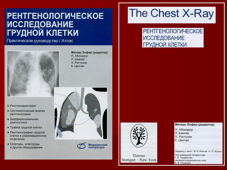 Легких автор. Хофер рентгенологическое исследование грудной клетки. Книга рентгенологическое исследование грудной клетки Хофер. Рентгенологическое исследование Матиас Хофер. Книга лучевая диагностика заболевания органов грудной клетки.