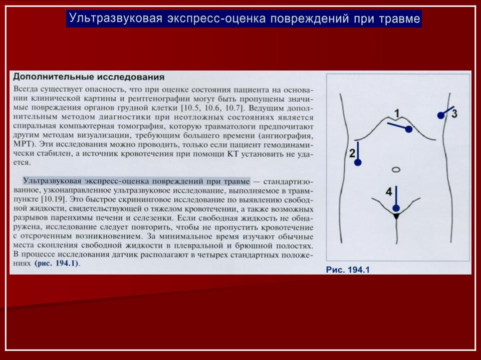 Огк это. ОГК исследование. Методы рентгенологического исследования ОГК В медицине. ОГК В медицине норма. Лучевая диагностика ОГК.