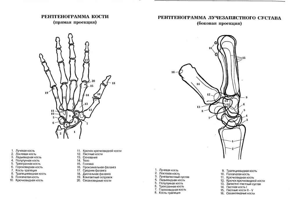 Суставы проекция. Суставы запястья рентген анатомия. Лучезапястный сустав рентген норма анатомия. Рентгеноанатомия кисти и лучезапястного сустава. Кости запястья рентген анатомия.