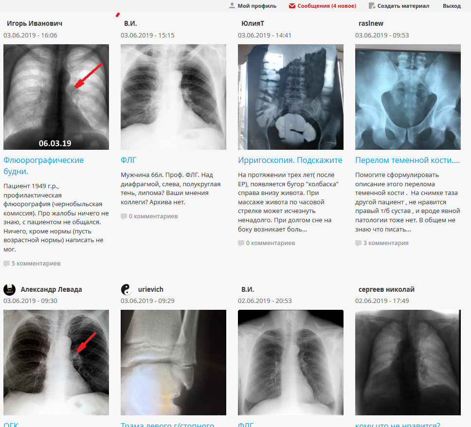 Профиль сообщения. Флюорографические снимки таза. Показывает ли флюорография паразитов.