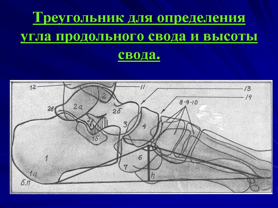 Боковая проекция стопы рентген фото