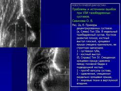 Ошибки при узи тазобедренных суставов