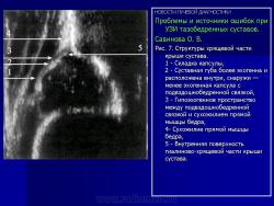 Ошибки при узи тазобедренных суставов