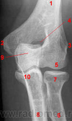 Рентген анатомия локтевого сустава