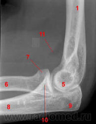 Рентген анатомия локтевого сустава