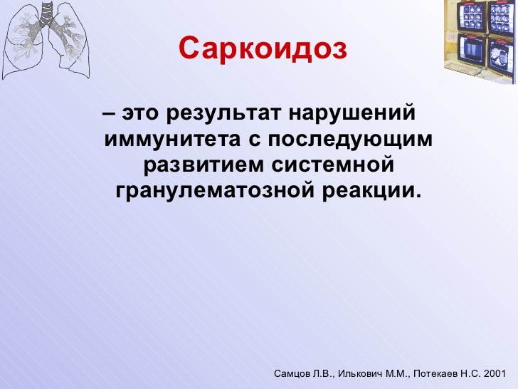 Саркоидоз это. Саркоидоз диагностика. Саркоидоз диагноз. Саркоидоз формирование иммунитета. Саркоидоз кожи дифференциальная.