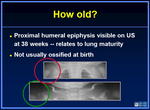 010_proximal_humeral_epiphysis.jpg