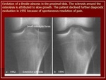 1.Abscess_BRODI.JPG