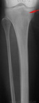 1.ch_.sl274226.jpg