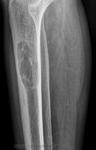 111.giperparat._osteodistr.jpg