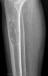 112giperparat._osteodistr.1.jpg