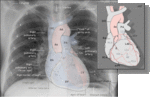 22.sn_.heart_in_radiographs_label.gif