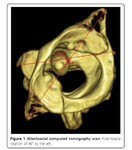 c1-c2_rotation_2.jpg