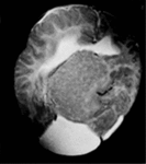 f10.mediumpodkorkovye_geterotopiy.gif