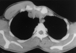 f10.mediumpolsha_sindrom.gif