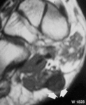 f12.mediumksantomy_podoshvennoy_fascii.gif