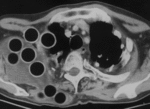 f18.mediumplombage.gif