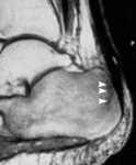 f19.mediumstress_razrusheniya.gif