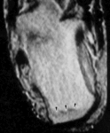 f20.mediumstress_razrusheniya.gif