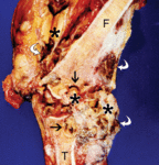 f24.mediumdiffuznye_pvns.gif