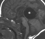 f7.mediumveny_galena_urodstvo.gif