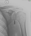 f_humerus_20140610_100650.jpg