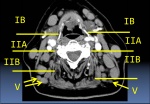 neck_05_ib-iia-iib-v.jpg