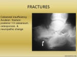 02-19_fractures.jpg