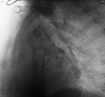 1378_lst_0000.jpg