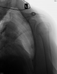 1378_lst_0001.jpg