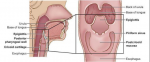 2015-09-04_20-59-05_radiografiya-2015._minsk._prezentaciya._kt-diagnostika_raka_shei_-_pdf.pdf_str._68_iz_110.png