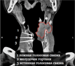 2015-09-04_21-10-54_mpr024_9.png_2.png