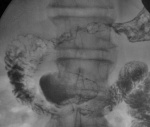 55.17.diver_apr.jpg