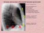 luchevaya_diagnostika_zabolevanij_organov_sredosteniya2.jpg