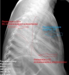 rentgenogramma_17985_lotikov_a-1.jpg