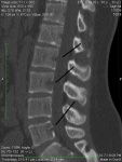 sagittal_0006.jpg