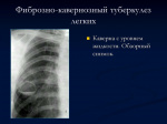 Танталовы швы что это. Танталовы швы что это фото. картинка Танталовы швы что это. смотреть фото Танталовы швы что это. смотреть картинку Танталовы швы что это.