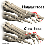 foot_clawtoes_anat03.jpg