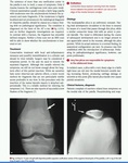 patella3_cr.jpg